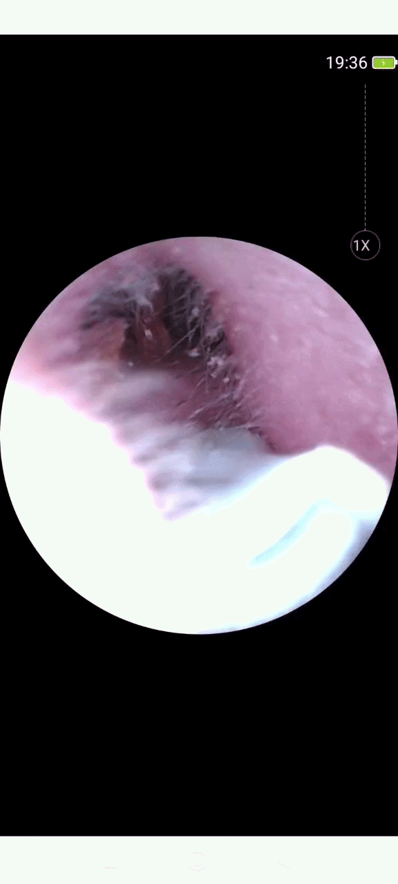 Ceruvix™ Akıllı Kameralı Kulak Temizleme Cihazı