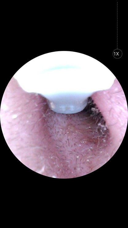 Ceruvix™ Akıllı Kameralı Kulak Temizleme Cihazı