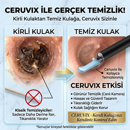 Ceruvix™ Akıllı Kameralı Kulak Temizleme Cihazı